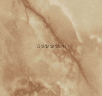 105г Оникс Стандарт Про (Н38мм)